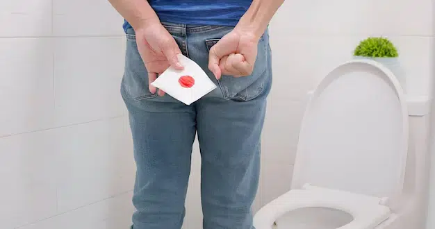 Haemorrhoids
