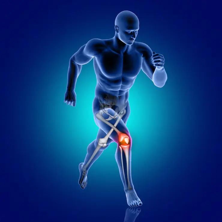 Joint Pain