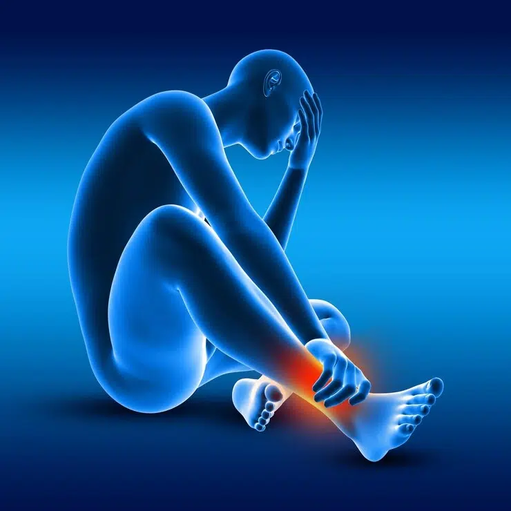 Sprains and Strains