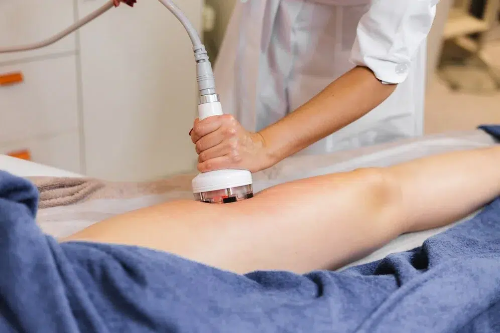 Ultrasound Cavitation