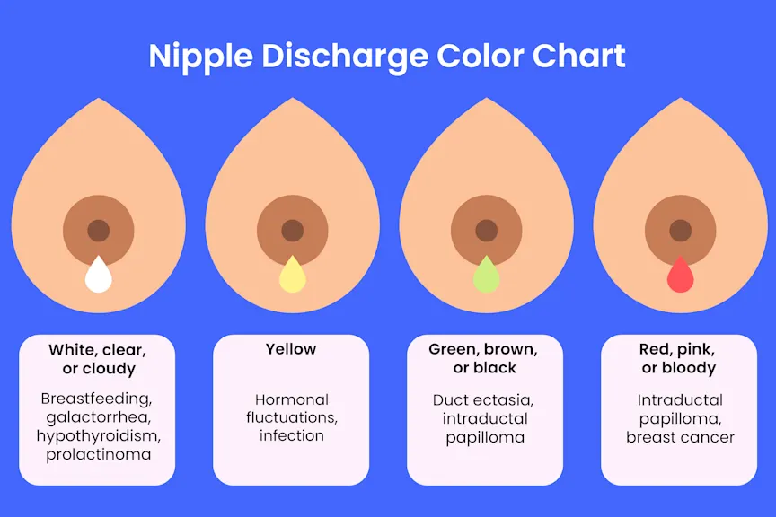Nipple Discharge