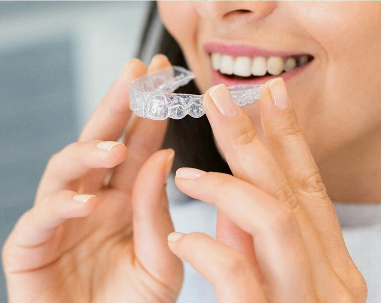 invisalign braces north london